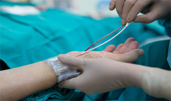 coronar angiography treatment in south delhi
